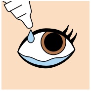 抗VEGF薬治療（硝子体内注射）の眼内注射をおこなう前後の注意点